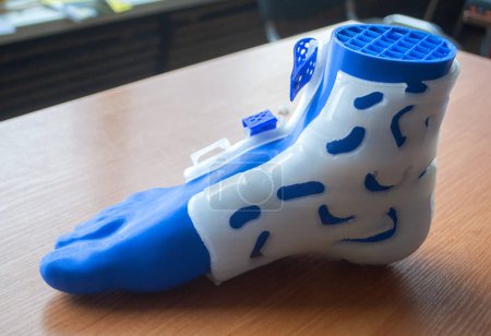Medizin-Schienen-Korsett-Prothese für Fuß und Modell des menschlichen Fußes auf 3D-Drucker aus geschmolzenem Kunststoff gedruckt. Medizinische Orthese, Fixator, Kunststoff-Overlay für Bein und menschliches Bein im 3D-Drucker