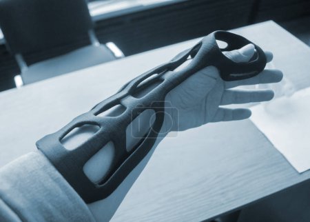 Hand-Arm-Schienen-Korsett-Prothese auf 3D-Drucker aus geschmolzenem Kunststoff gedruckt. Medizinische Orthese Fixator Kunststoff-Overlay auf 3D-Drucker erstellt. Neue moderne medizinische 3D-Drucktechnologien