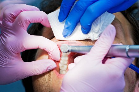 Téléchargez les photos : Dentist treats the front teeth to the patient - en image libre de droit