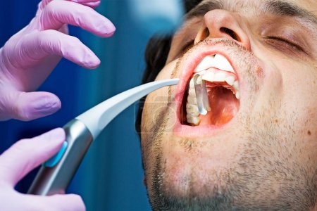 Téléchargez les photos : Dentist treats the front teeth to the patient - en image libre de droit