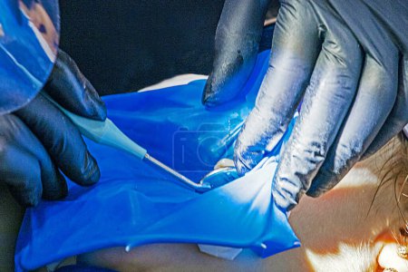 Téléchargez les photos : Dentiste et assistant portent des gants et mettent un film de caoutchouc avant de traiter une dent malade. - en image libre de droit