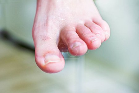 ein Mann schneidet seine Fußnägel in einer Unschärfe. Fußpflege
