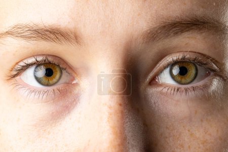 Photo for Close up of brown eyes of caucasian woman with freckles. Medicine, healthcare and science concept. - Royalty Free Image