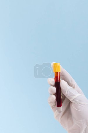Téléchargez les photos : Main en gant chirurgical blanc tenant tube d'échantillon de sang, sur fond bleu avec espace de copie. Diagnostic, analyse et don de sang. - en image libre de droit