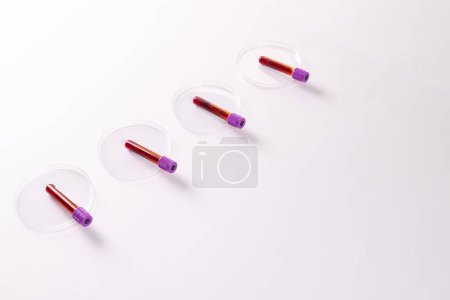 Téléchargez les photos : Rangée de tubes échantillons de sang dans des boîtes de Pétri, sur fond blanc. Diagnostic, analyse et don de sang. - en image libre de droit