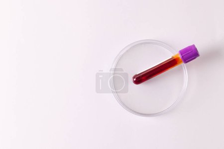 Photo for Blood sample tube in petri dish, on white background with copy space. Blood health diagnostics, analysis and blood donation. - Royalty Free Image