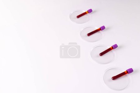 Téléchargez les photos : Rangée de tubes échantillons de sang dans des boîtes de Pétri, sur fond blanc avec espace de copie. Diagnostic, analyse et don de sang. - en image libre de droit