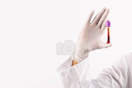 Téléchargez les photos : Main en gant chirurgical blanc tenant tube d'échantillon de sang, sur fond blanc avec espace de copie. Diagnostic, analyse et don de sang. - en image libre de droit