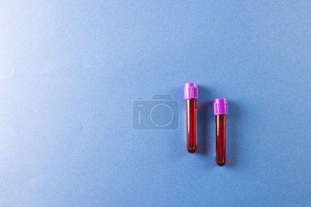 Photo for Two blood sample tubes with purple lids, on blue background with copy space. Blood health diagnostics, analysis and blood donation. - Royalty Free Image