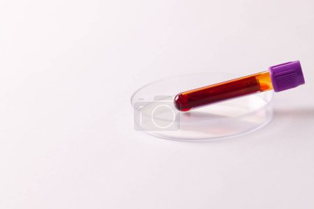 Photo for Blood sample tube in petri dish, on white background with copy space. Blood health diagnostics, analysis and blood donation. - Royalty Free Image