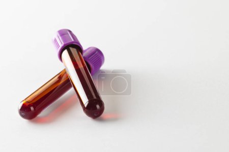 Téléchargez les photos : Deux tubes échantillons de sang avec couvercles violets, sur fond blanc avec espace de copie. Diagnostic, analyse et don de sang. - en image libre de droit