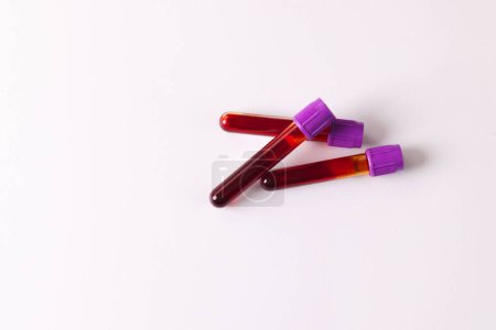 Téléchargez les photos : Trois tubes échantillons de sang avec couvercles violets, sur fond blanc avec espace de copie. Diagnostic, analyse et don de sang. - en image libre de droit