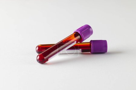 Téléchargez les photos : Deux éprouvettes de sang avec couvercles violets, sur fond blanc. Diagnostic, analyse et don de sang. - en image libre de droit