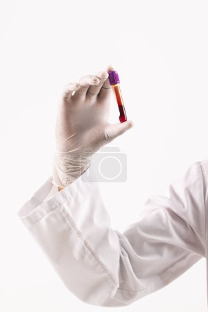 Photo for Hand in white surgical glove holding blood sample tube, on white background. Blood health diagnostics, analysis and blood donation. - Royalty Free Image