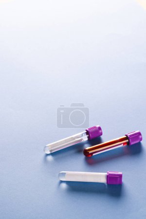 Téléchargez les photos : Trois tubes à échantillon avec couvercles violets, dont un contenant du sang, sur fond bleu avec espace de copie. Diagnostic, analyse et don de sang. - en image libre de droit