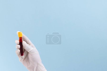 Téléchargez les photos : Main en gant chirurgical blanc tenant tube d'échantillon de sang, sur fond bleu avec espace de copie. Diagnostic, analyse et don de sang. - en image libre de droit