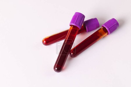 Téléchargez les photos : Trois éprouvettes de sang avec couvercles violets, sur fond blanc. Diagnostic, analyse et don de sang. - en image libre de droit
