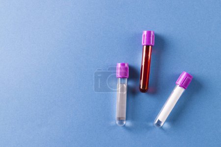 Foto de Tres tubos de muestra con tapas de color púrpura, uno conteniendo sangre, sobre fondo azul con espacio para copiar. Diagnóstico, análisis y donación de sangre. - Imagen libre de derechos