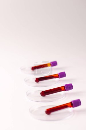 Téléchargez les photos : Rangée de tubes échantillons de sang dans des boîtes de Pétri, sur fond blanc avec espace de copie. Diagnostic, analyse et don de sang. - en image libre de droit