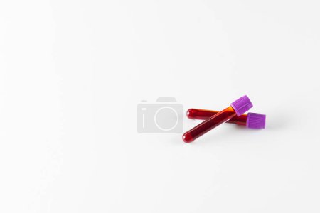 Photo for Two blood sample tubes with purple lids, on white background with copy space. Blood health diagnostics, analysis and blood donation. - Royalty Free Image