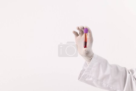 Foto de Guante quirúrgico de mano en blanco con tubo de muestra de sangre, sobre fondo blanco con espacio para copiar. Diagnóstico, análisis y donación de sangre. - Imagen libre de derechos