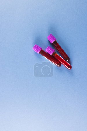 Téléchargez les photos : Trois tubes échantillons de sang avec couvercles violets, sur fond bleu avec espace de copie. Diagnostic, analyse et don de sang. - en image libre de droit
