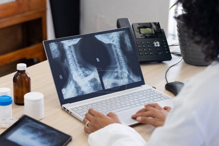 Photo for Biracial female doctor using laptop with radiograph on screen at doctor's office. Hospital, medicine, healthcare and communication. - Royalty Free Image