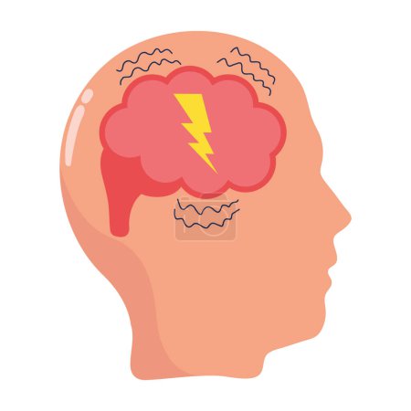 Illustrationsvektor für Parkinson-Erkrankungen im Gehirn