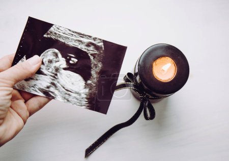 Photo for Conceptual image of woman mourning, miscarriage. Mother hand holding ultrasound picture of baby. Black candle with black ribbon burning. - Royalty Free Image