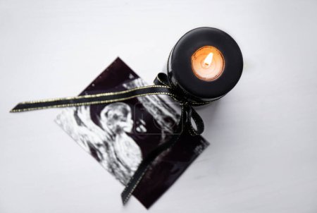 Photo for Conceptual image of mourning, miscarriage, pregnancy loss or grief counseling. Ultrasound picture of baby next to black candle with black ribbon burning. - Royalty Free Image