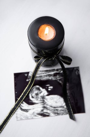 Photo for Conceptual image of mourning, miscarriage, pregnancy loss or grief counseling. Ultrasound picture of baby next to black candle with black ribbon burning. - Royalty Free Image