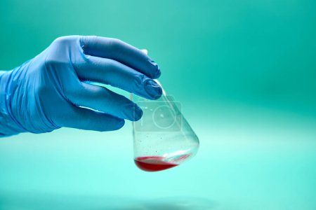 Mano del médico anónimo en guante de látex sosteniendo matraz cónico con muestra química roja en laboratorio durante la prueba de diagnóstico