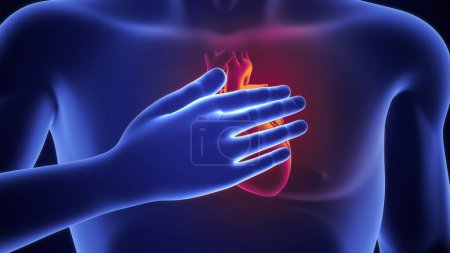 Foto de 3d ilustración de ataque al corazón en el cuerpo azul - Imagen libre de derechos