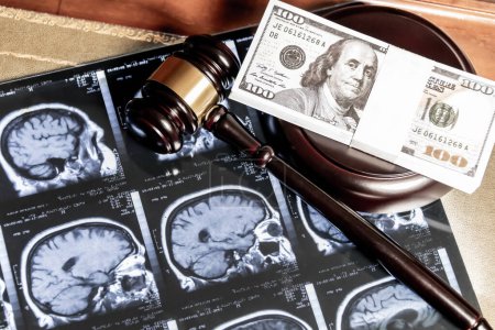 A concept image depicting MRI brain scans overlaid with a judges gavel and cash, implying legal and financial aspects of healthcare