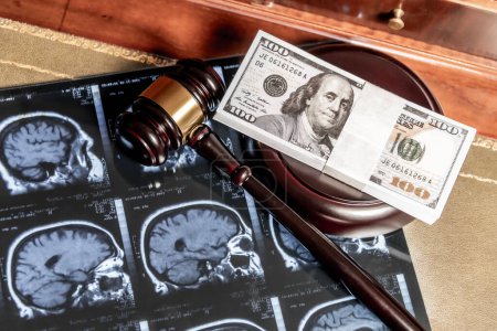 Eine Mischung aus rechtlichen und medizinischen Konzepten mit Gehirn-MRT-Bildern, einem Hammer und einer US-Währung