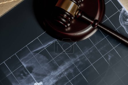 Téléchargez les photos : Une radiographie sous un marteau en bois, suggérant des problèmes juridiques liés aux procédures médicales ou à la santé - en image libre de droit