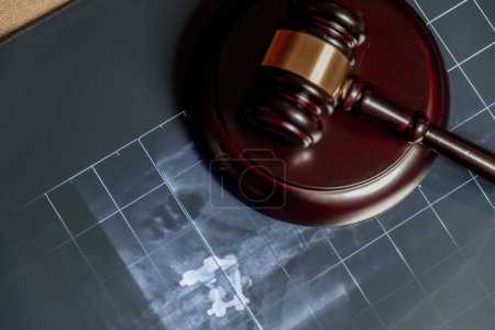Téléchargez les photos : Une radiographie sous un marteau en bois, suggérant des problèmes juridiques liés aux procédures médicales ou à la santé - en image libre de droit