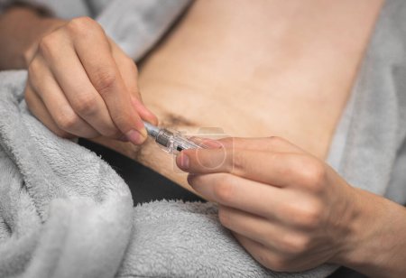 Step 3.Hands of a young caucasian man in a gray robe with a bared belly are holding an opening syringe with a medicinal liquid for an injection,lying on a bed,side view close-up.Concept step by step