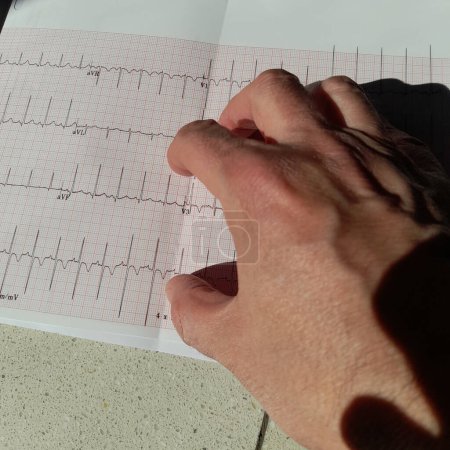 Main d'un médecin sur l'issue de l'électrocardiogramme