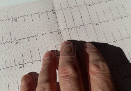 Hand eines Arztes am Elektrokardiogramm-Ergebnis