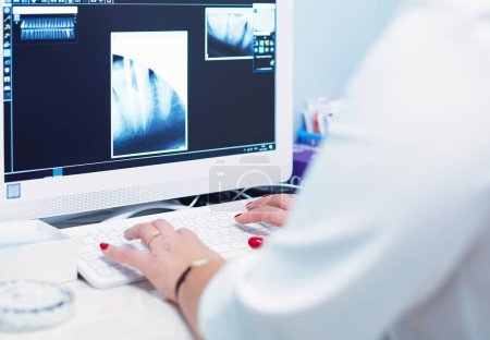 Photo for A female medical doctor looking at x-rays and using laptop in a hospital. - Royalty Free Image