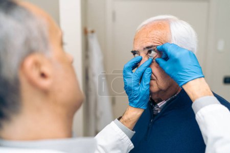 Ein Arzt setzt einem Patienten vor der Glaukom-Lasertherapie ein Spekulum ein.