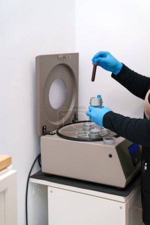 Téléchargez les photos : Placer les flacons de sang dans une centrifugeuse - en image libre de droit