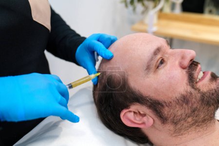 Klinik bietet PRP-Therapie bei Haarausfall bei Männern mit professioneller Pflege.