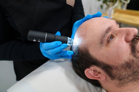 Photo for Professional performing scalp treatment on a male patient. - Royalty Free Image