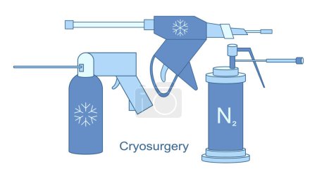 Téléchargez les illustrations : Instruments cryo pour l'illustration de lignes vectorielles de cryochirurgie. Refroidissement à l'azote liquide pour traitement cryogénique. Traitement par glace pour les lésions bénignes et malignes. - en licence libre de droit