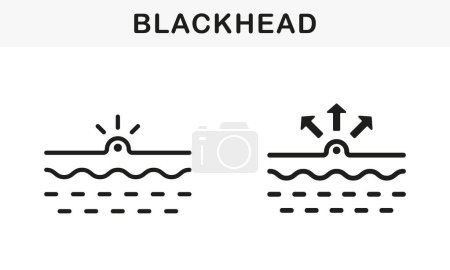 Illustration for Blackhead, Skin Acne, Comedo Line and Silhouette Black Icon Set. Pimple and Inflammation Sebum Pictogram. Deep Dirty Pore, Skin Problem Symbol Collection. Isolated Vector Illustration. - Royalty Free Image
