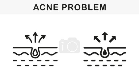 Illustration for Skin Acne, Pimple, Comedo Pictogram. Blackhead and Inflammation Sebum Line and Silhouette Black Icon Set. Dirty Skin Problem Symbol Collection. Isolated Vector Illustration. - Royalty Free Image