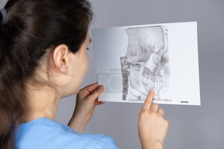 The doctor holds a CT scan of a patient with temporomandibular joint dysfunction and malocclusion