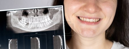Photo for A patient with malocclusion, missing chewing tooth and temporomandibular joint dysfunction holds his CT scan of the jaw - Royalty Free Image
